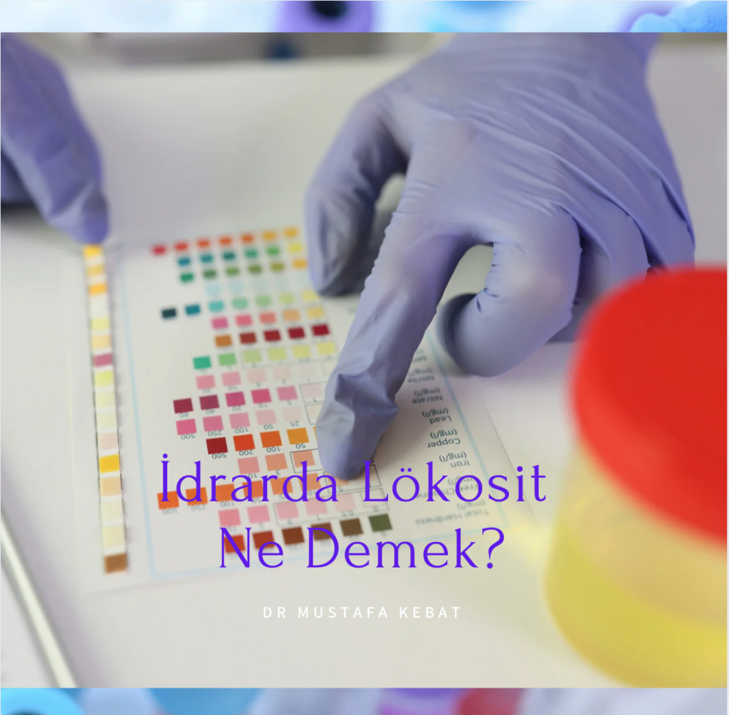 İdrarda Lökosit Var.... O da Ne Demek?