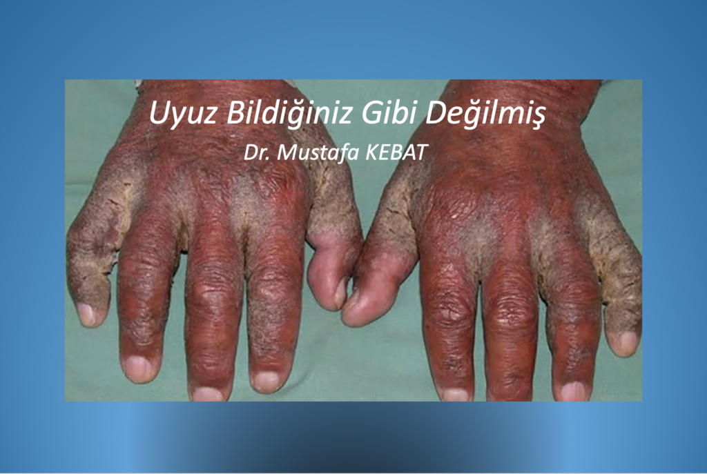 Bildiğiniz Gibi Değil Bu Uyuz