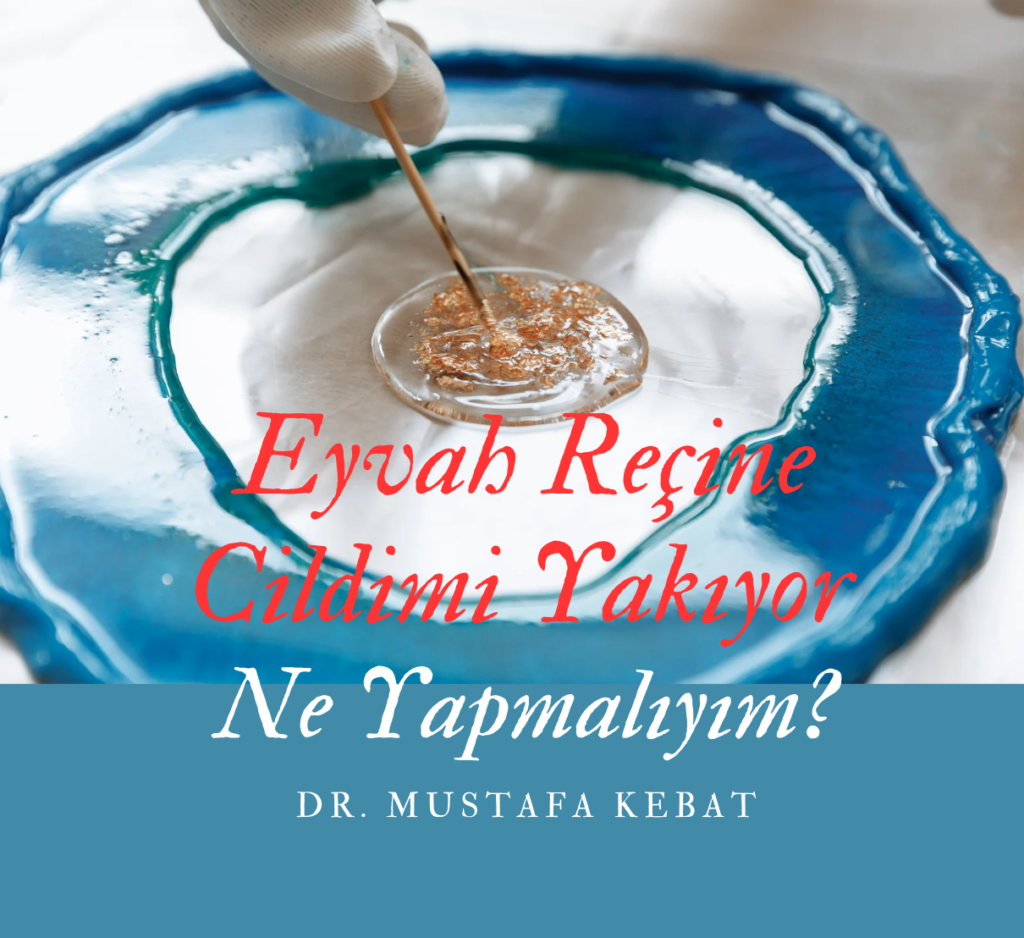 Eyvah Reçine Cildimi Yakıyor Ne Yapmalıyım?